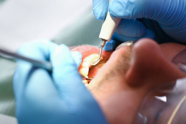 Best Emergency Orthodontic Repairs in Brookdale, CA